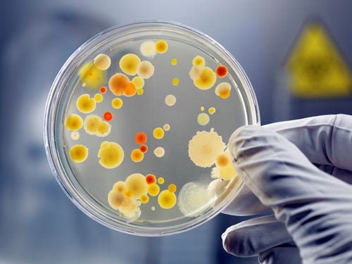 Gloved hand holding a petri dish of cultured bacteria